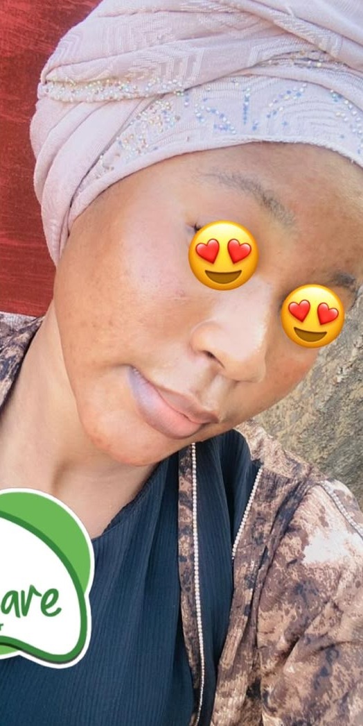 Après les soins BIOCARE — Mariam K., Lotion réparatrice anti-taches — 10 semaines