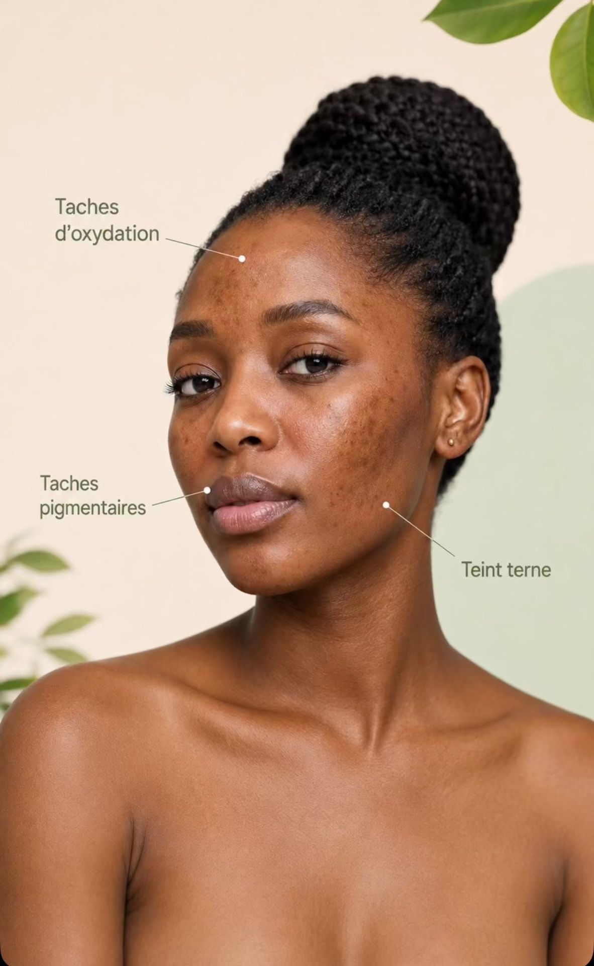 Portrait d'une femme noire avec annotations : taches d'oxydation, taches pigmentaires et teint terne